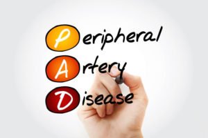 PAD doctor treatments peripheral artery disease