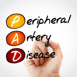 PAD doctor treatments peripheral artery disease