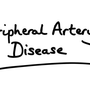 Peripheral Artery Disease Dr Aaron Kovaleski Treatment Options