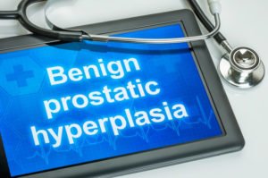 Benign Prostatic Hyperplasia treatment stethoscope display