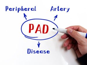 PAD Treatments