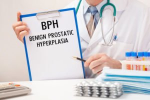 BPH Enlarged Prostate Treatment Options Talking To Doctor