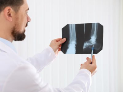 Interventional Radiologist Bone Health