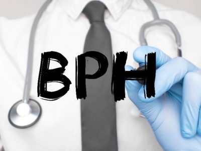BPH Enlarged Prostate Treatment