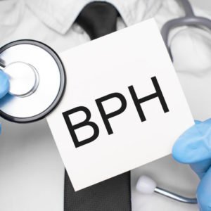 BPH Treatment Intervention Doctors