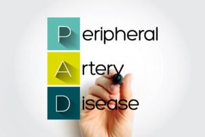 PAD Peripheral Artery Disease Endovascular Clinic ECCO Medical