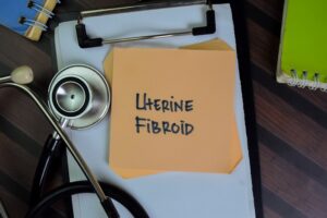 Uterine Fibroids Talking With A Colorado Doctor