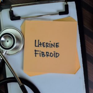 Uterine Fibroids Talking With A Colorado Doctor